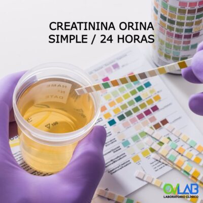 CREATININA ORINA SIMPLE / 24 HORAS