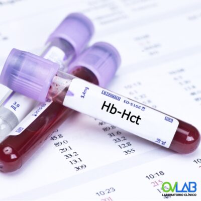 HEMOGLOBINA, HEMATOCRITO (HB-HTO)