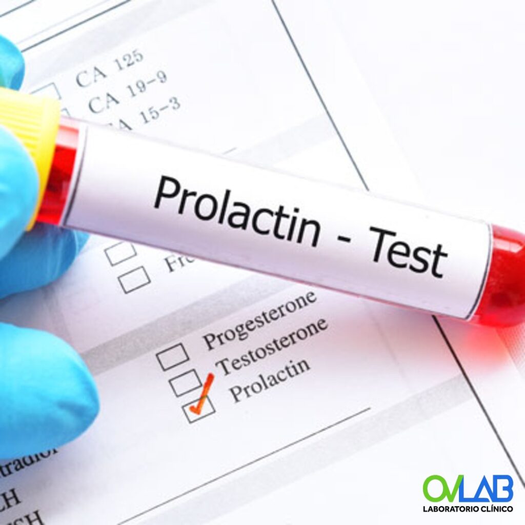 PROLACTINA – OVLAB – O&V Laboratorios
