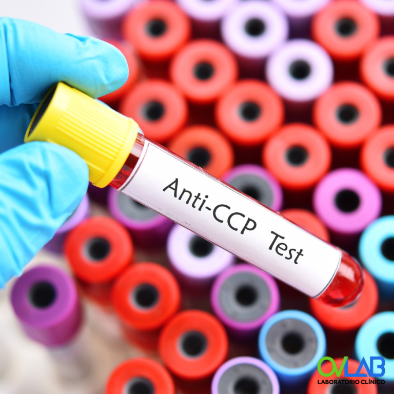 ANTICOAGULANTE LÚPICO OVLAB O&V Laboratorios