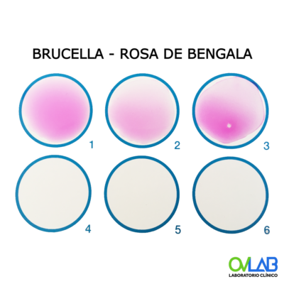 BRUCELLA – ROSA DE BENGALA