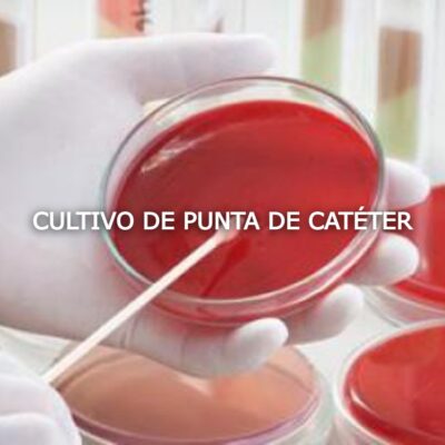 CULTIVO DE PUNTA DE CATÉTER