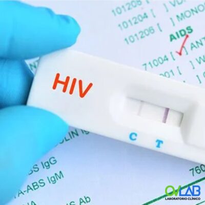 HIV 1, 2 ANTÍGENO ANTICUERPO