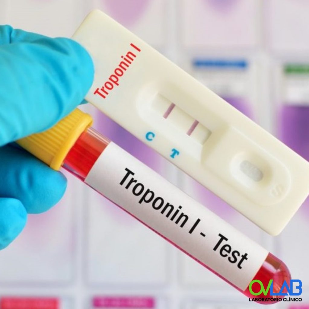 TROPONINA I – OVLAB – O&V Laboratorios